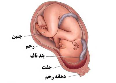 از هفته چندم بارداری دهانه رحم باز میشود، باز شدن دهانه رحم زودتر از موعد،  برای باز شدن دهانه رحم چه بخوریم،  جلوگیری از باز شدن دهانه رحم در بارداری،  باز شدن دهانه رحم به اندازه یک سانت،  ورزش برای باز شدن دهانه رحم،  زعفران برای باز شدن دهانه رحم