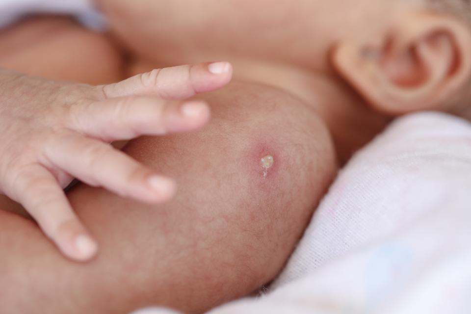 واکسن بدو تولد