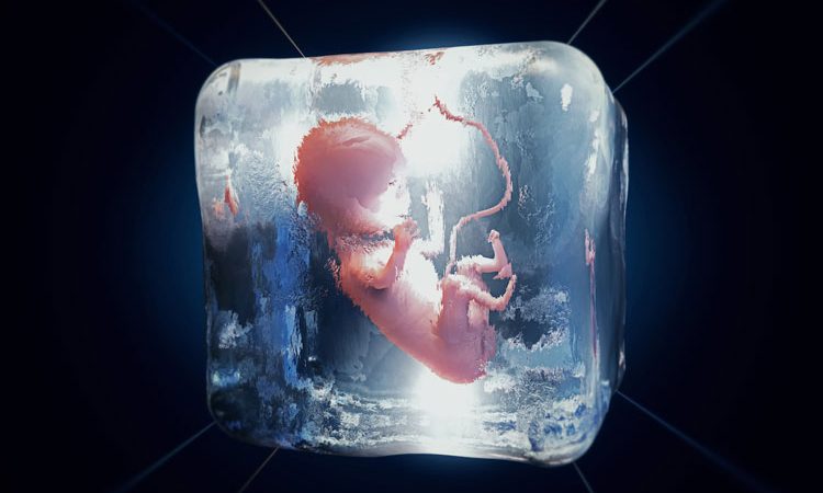 روش انتقال جنین یخ زده (FET)