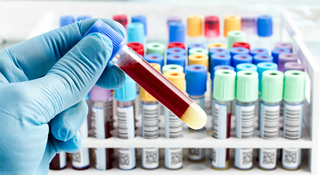 آزمایشات خونی برای یافتن علت سقط جنین