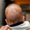 چگونه از صاف شدن سر نوزاد جلوگیری کنیم؟
