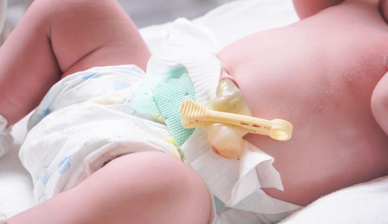 همه چیزهایی که باید درباره بند ناف نوزادن بدانید