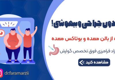 بوتاکس معده