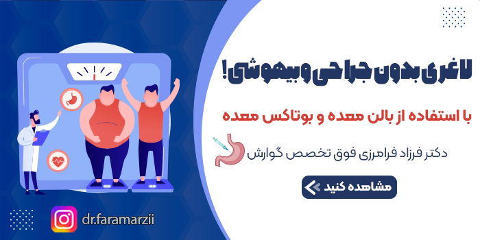 بوتاکس معده